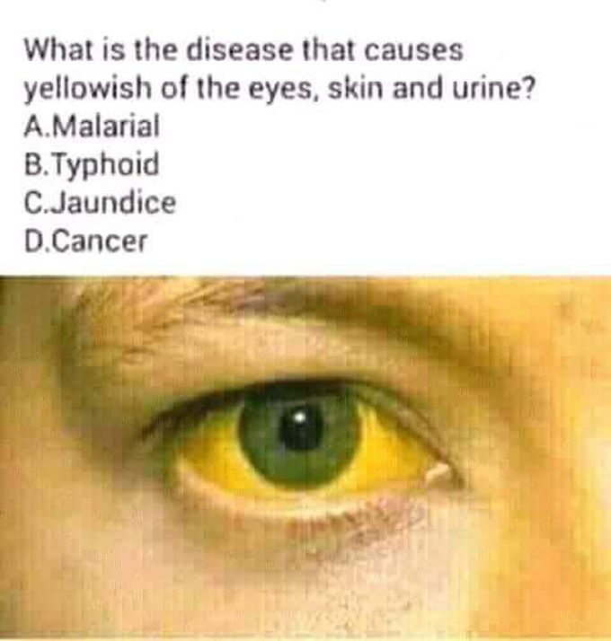 Answer