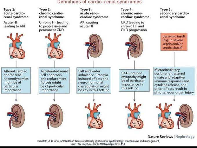 Cardio renal syndrome