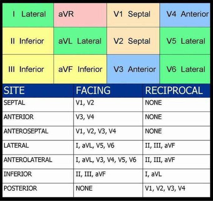 ECG leads and their corresponding myocardial sites