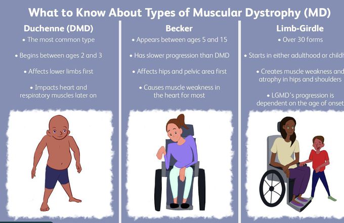 Muscular dystrophy