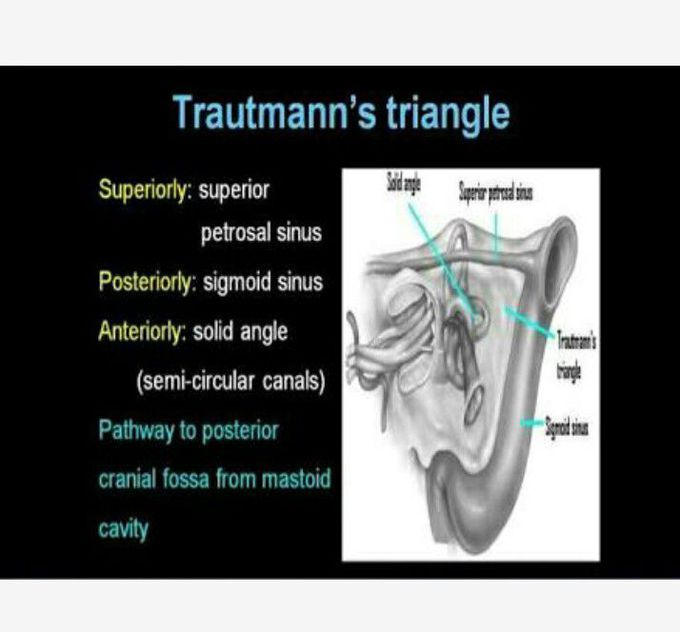 Trautmanns triangle