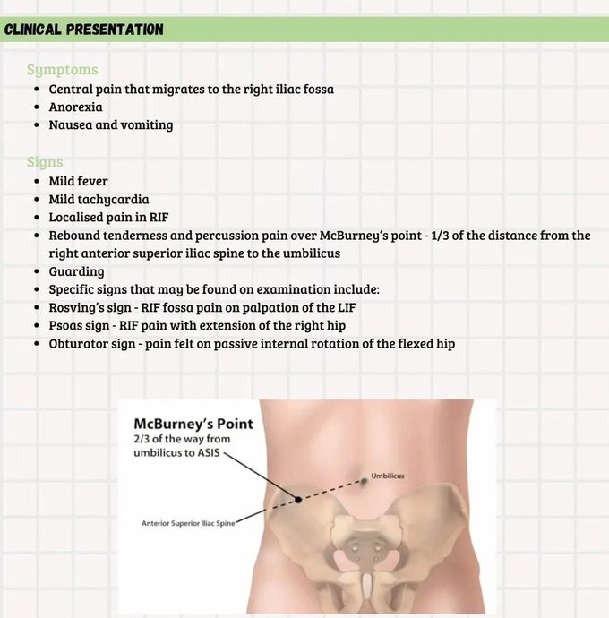 Appendicitis II