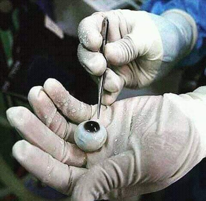The actual image of the eye😇