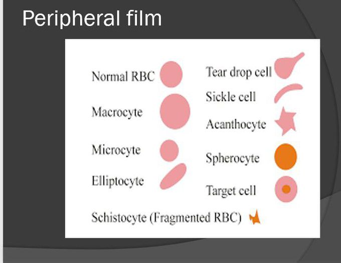 RBCs on Peripheral Film