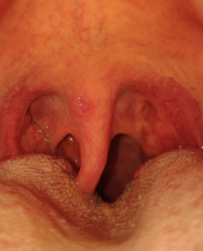 Any diagnosis??