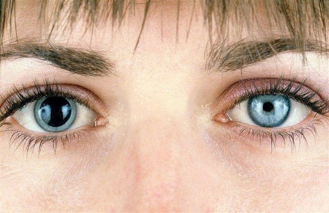 Causes of Pinpoint Pupils