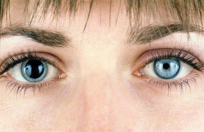 Causes Of Pinpoint Pupils MEDizzy