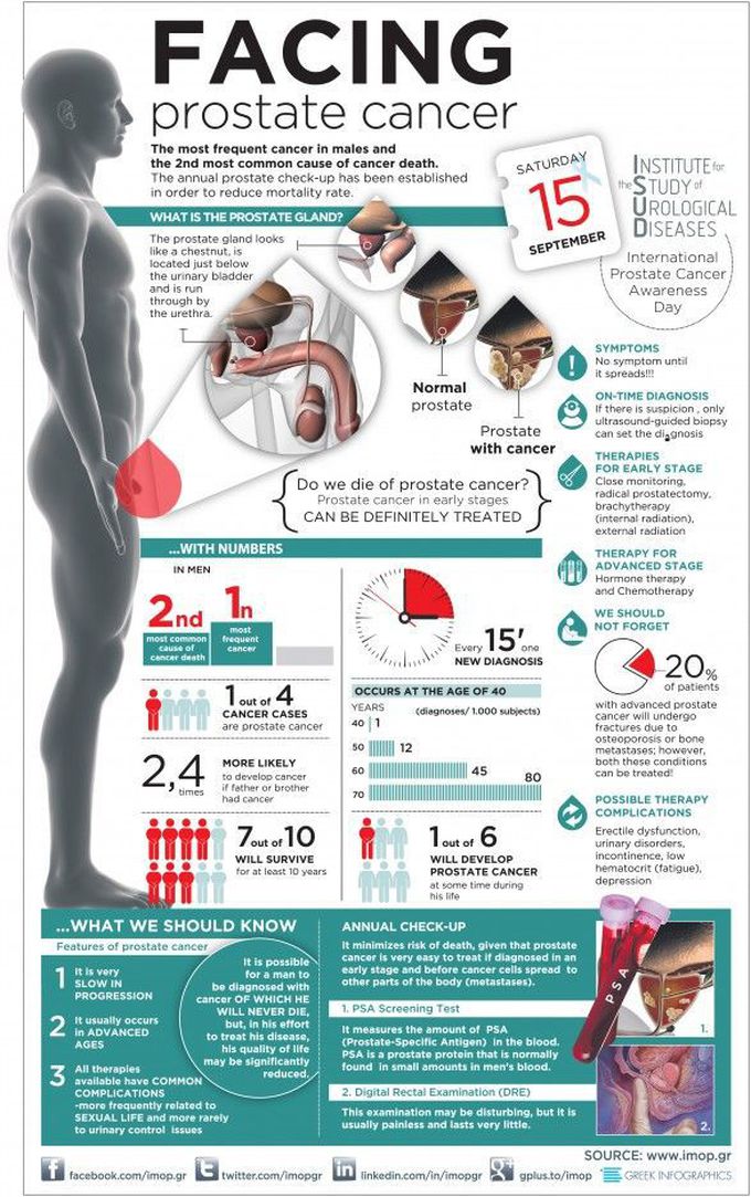 Prostate Cancer Infographic