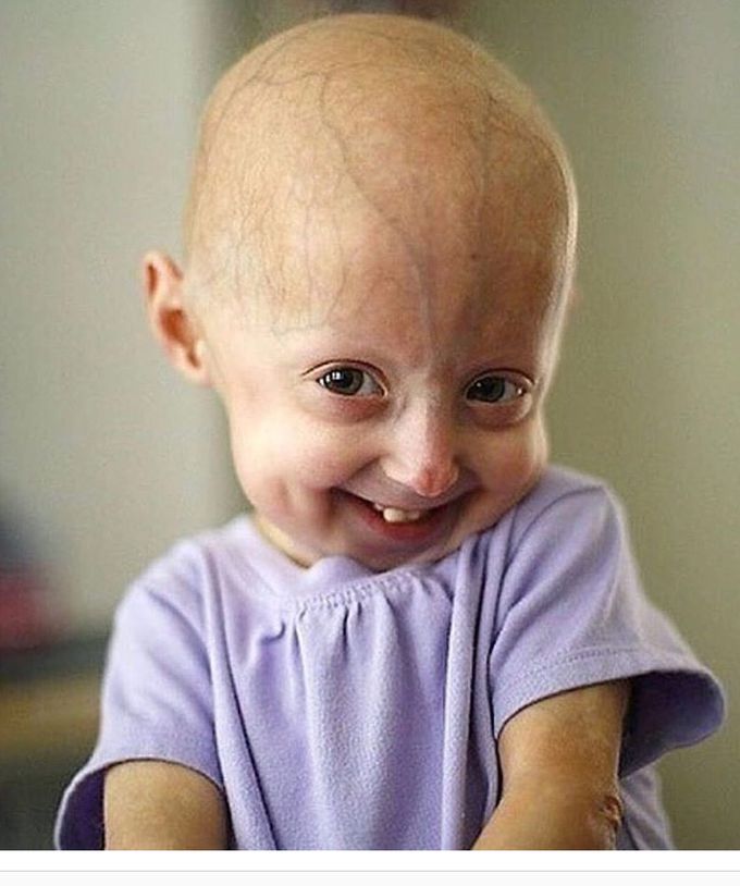 Everyone deserves a beautiful life.