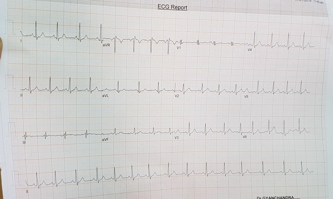 Whats your diagnose??