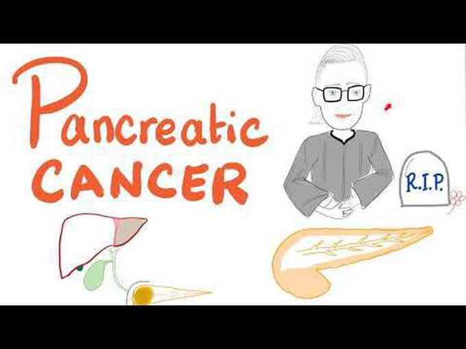 Pancreatic Cancer