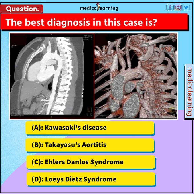 Comment your answers