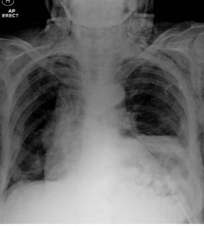 Diagnose plz ?