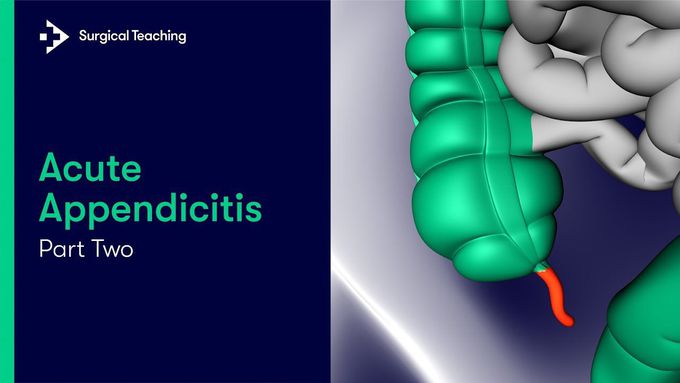 What Causes Acute Appendicitis? Part Two