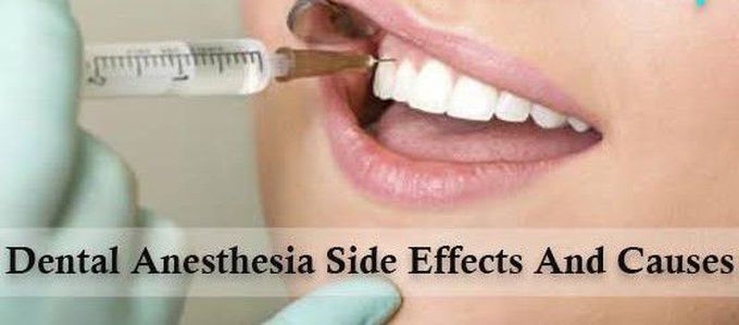 Dental anesthesia side effects