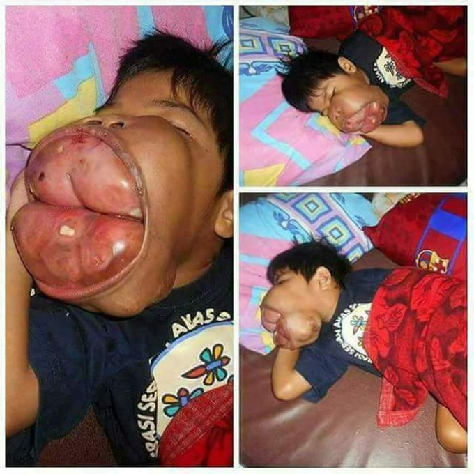 What is the name of this disease?????