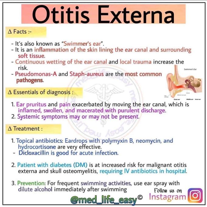 Otitis externa