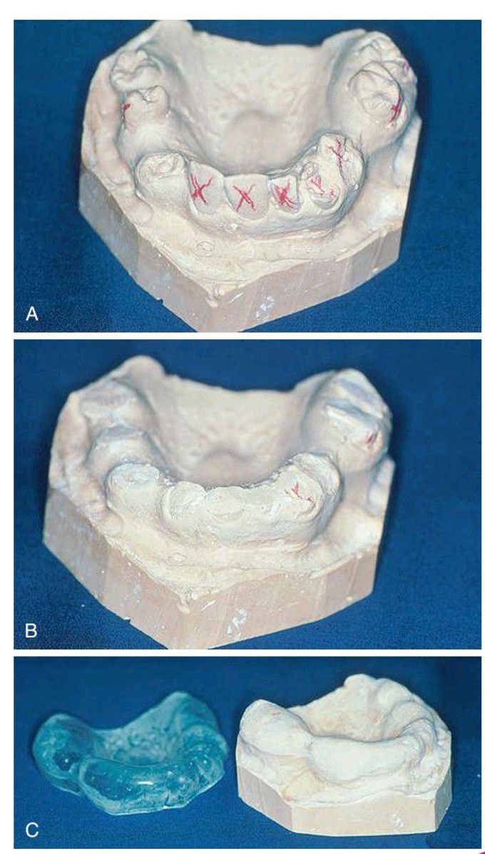 Surgical guide