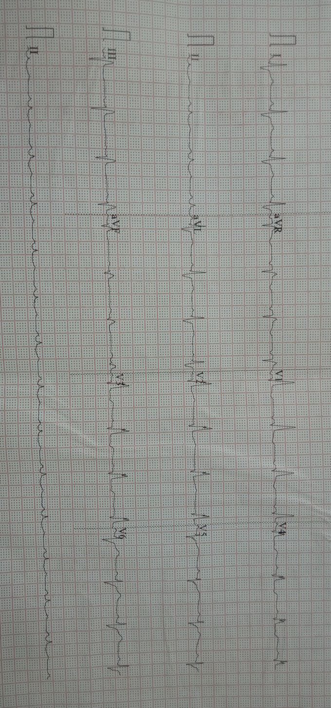 What's your diagnosis?