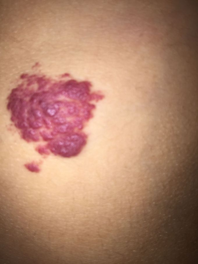 What’s your diagnosis??