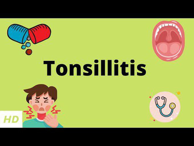 What is Tonsillitis? - Basics