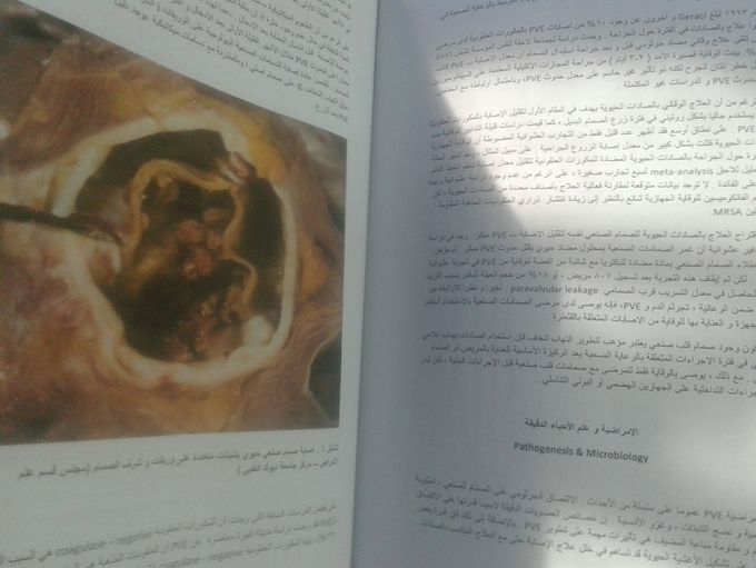 My graduation project ☕