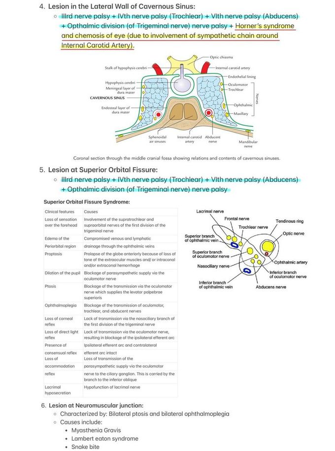 Oculomotor Nerve IV