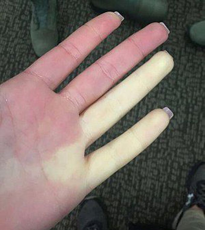 What is your diagnosis!!?