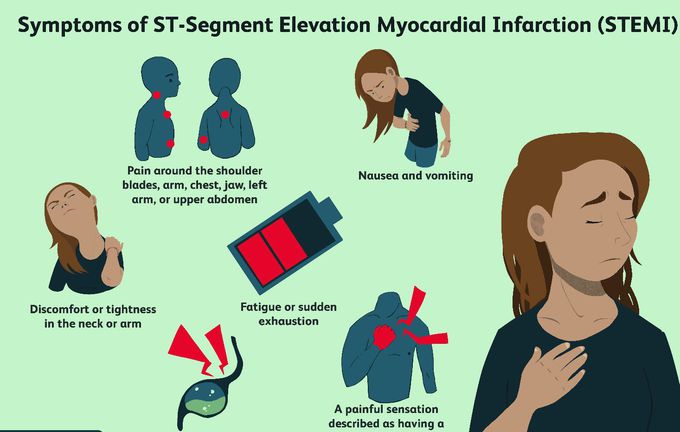 ST segment elevation myocardial infarction (STEMI)