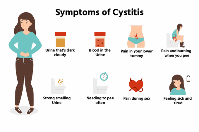 Symptoms of cystitis