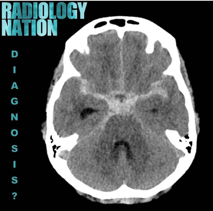 What's your diagnosis?