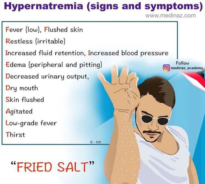 hypernatremia mnemonic