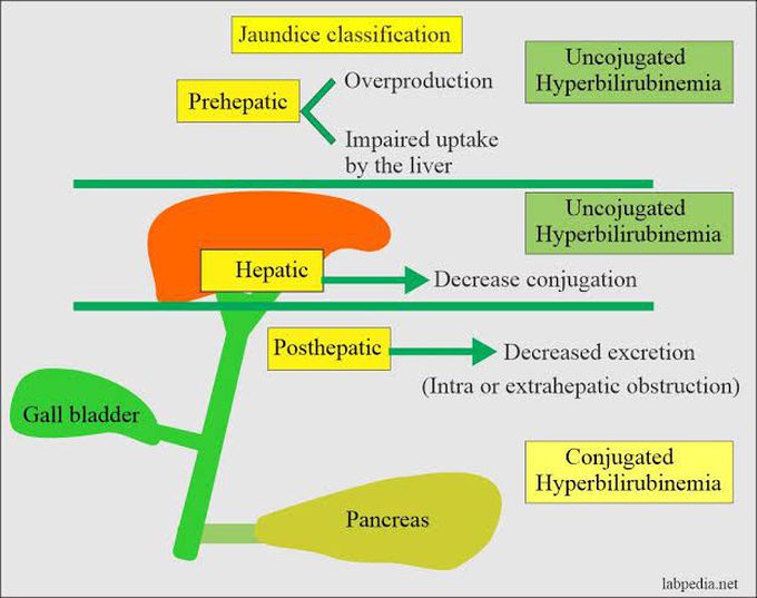 Jaundice Classification