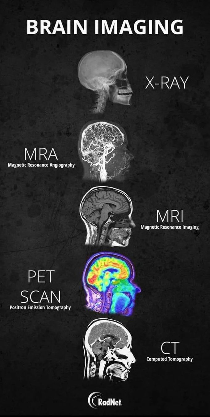 Different imaging