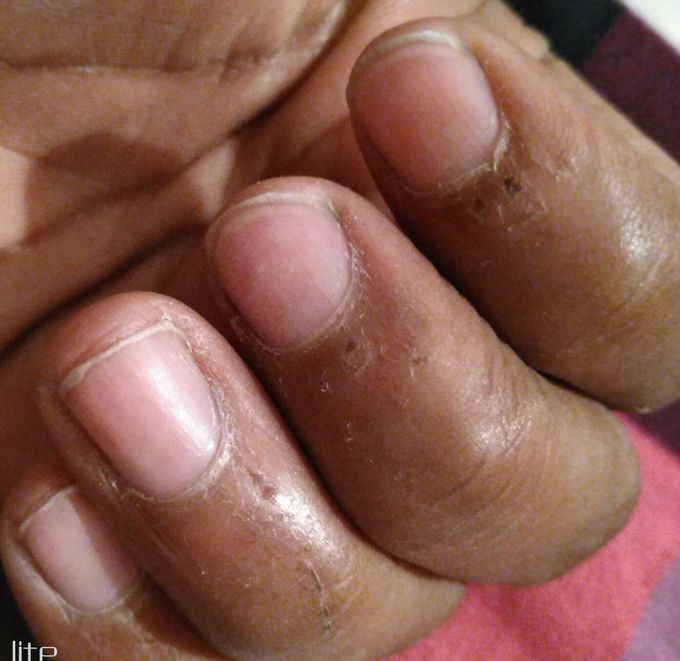 Diagnosis???