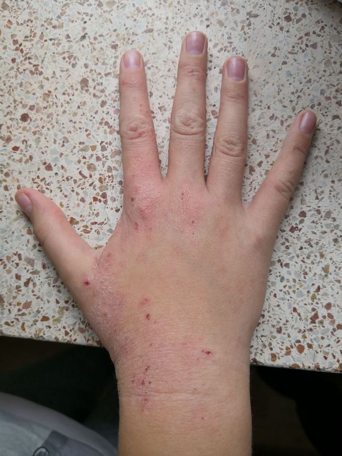 Please write me your diagnosis and suggestion for treatment