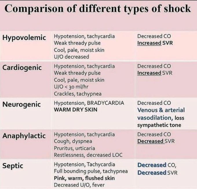 Different types of shocks