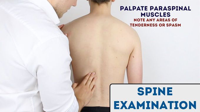 Spine Examination - OSCE Guide