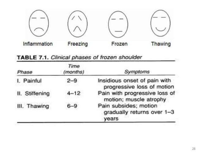 Clinical Phases of Frozen Shoulder