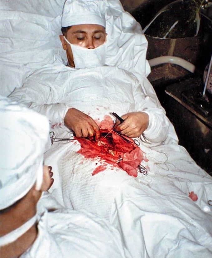 Self surgery 😮
