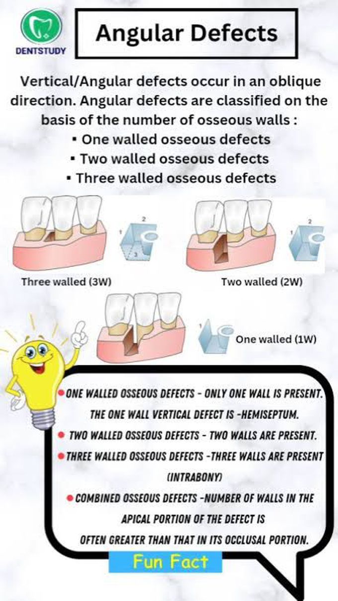 Angular Defects