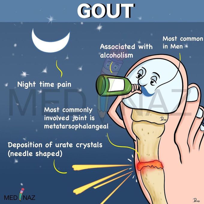Gout