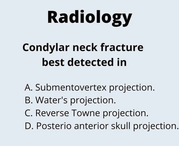 Condylar neck fracture