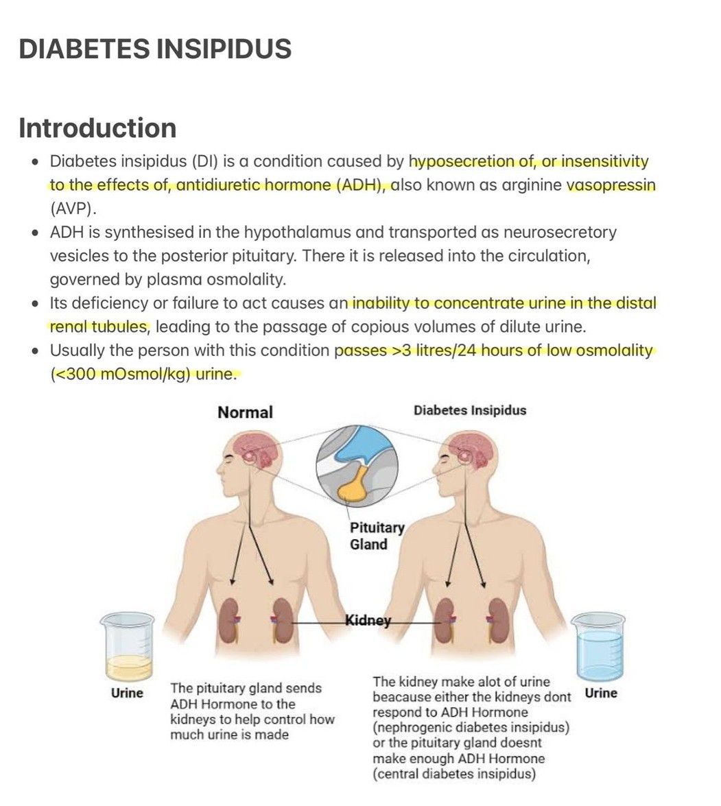 Diabetes Insipidus I   MEDizzy