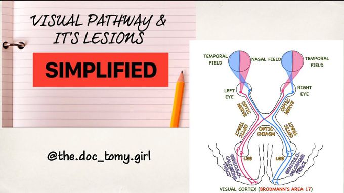 THE VISUAL PATHWAY & It's Lesions | Physiology |Ophthalmology