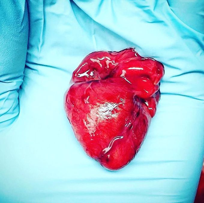 An incredibly small heart pulled out from a dead fetus