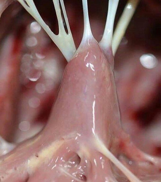 Chordae tendineae