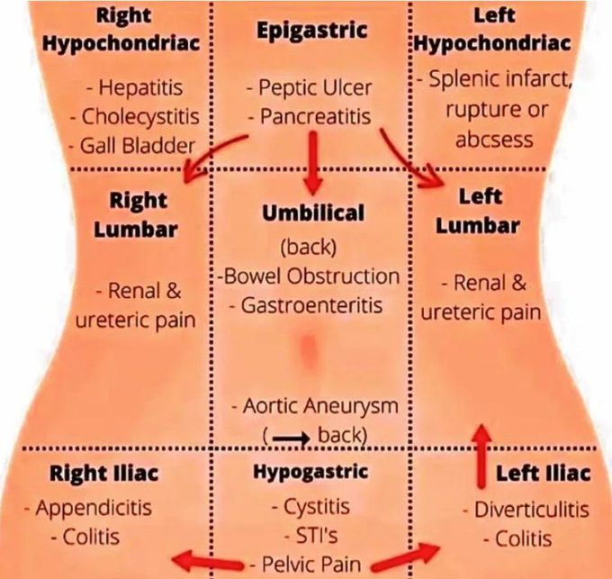 Acute Abdomen