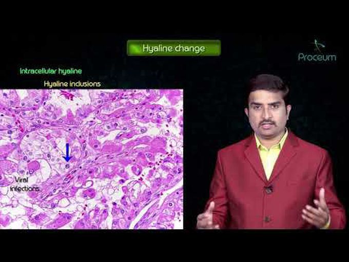 Reversible Cell Injury - Morphology