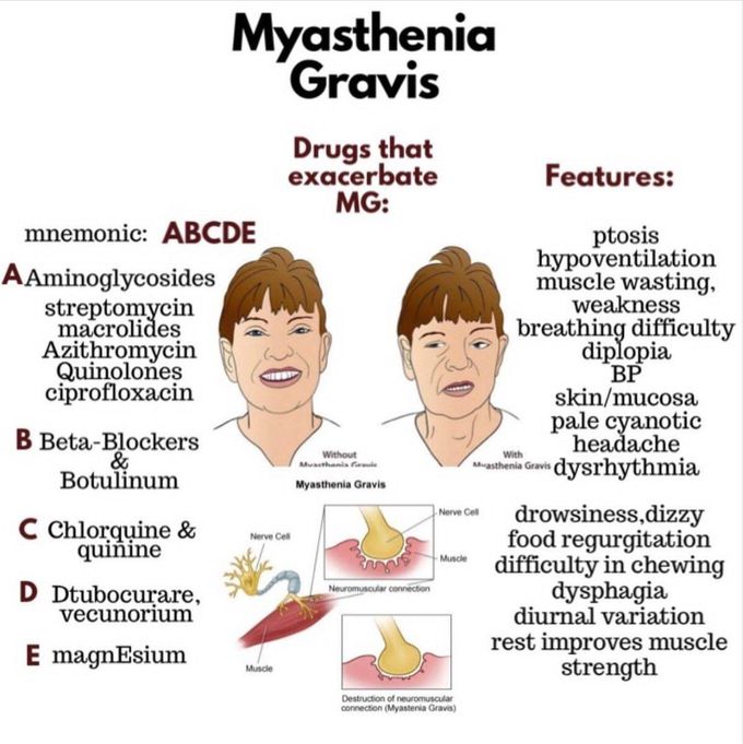 Myasthenia Gravis